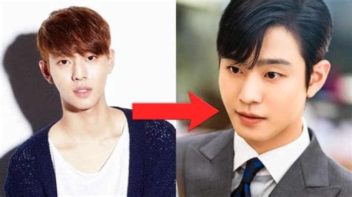 Ahn Hyo Seop Plastic Surgery, Has