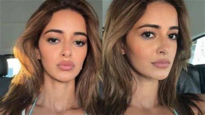 Alanna Panday Plastic Surgery Before And After Photo Business Guide Africa