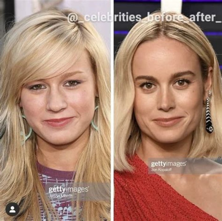 Brie Larson Plastic Surgery Brie Larson Plastic Surgery