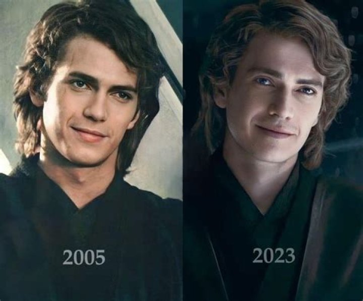 Does Hayden Christensen Undergo Plastic Surgery? Before And After Photos