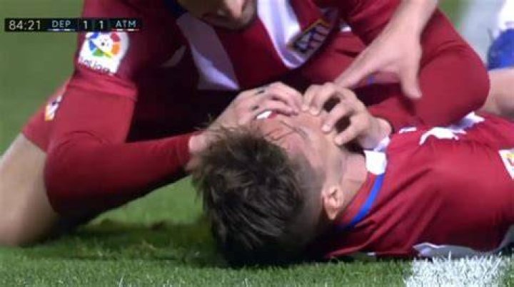 Fernando Torres Swallowed Tongue And Head Injury Update