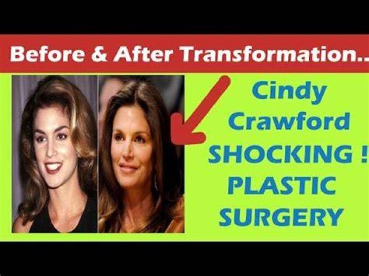 Has Cindy Crawford Had Plastic Surgery? Know the Truth Here