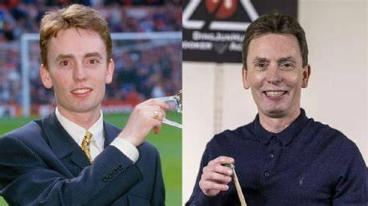 How Did Ken Doherty Get The Scar On His Face? What Happened To Him? Cheek Mark Explained