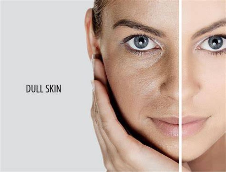 how to brighten dull skin